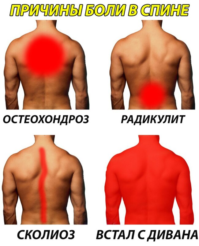 причины боли мем (1)