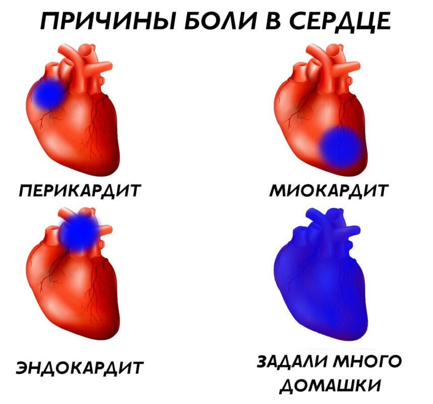 причины боли мем (3)