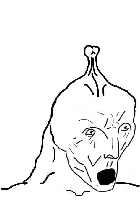 Микромозг brainlet Микромозг brainlet