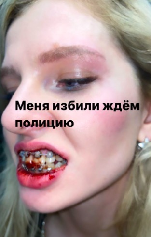 меллстрой избивает девушку меллстрой избивает девушку