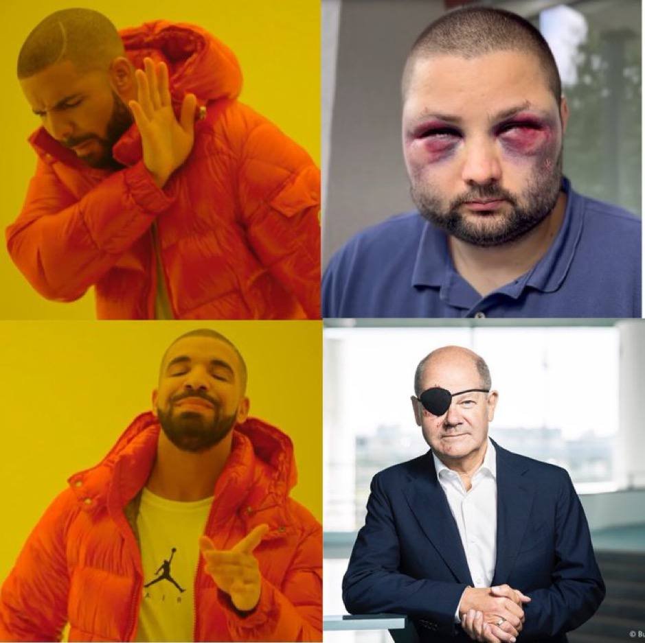 Шольц с повязкой на глазу